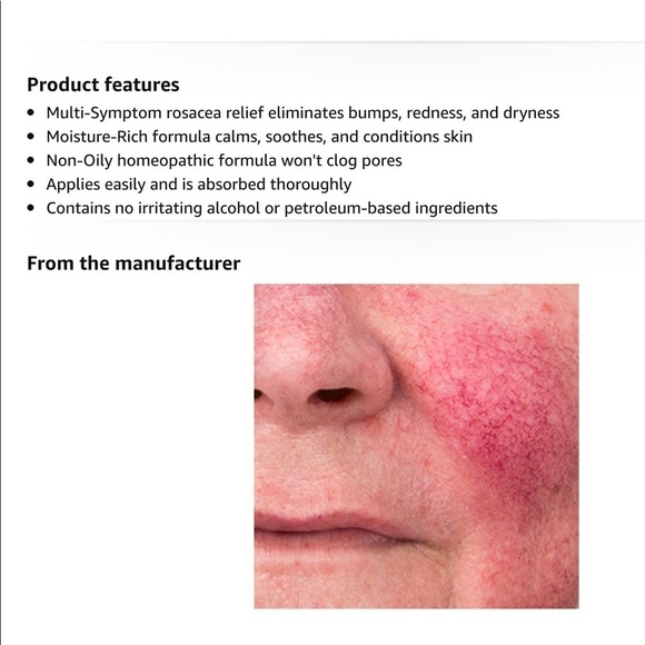 Prosacea Rosacea Treatment Topical Gel - Picture 3 of 7